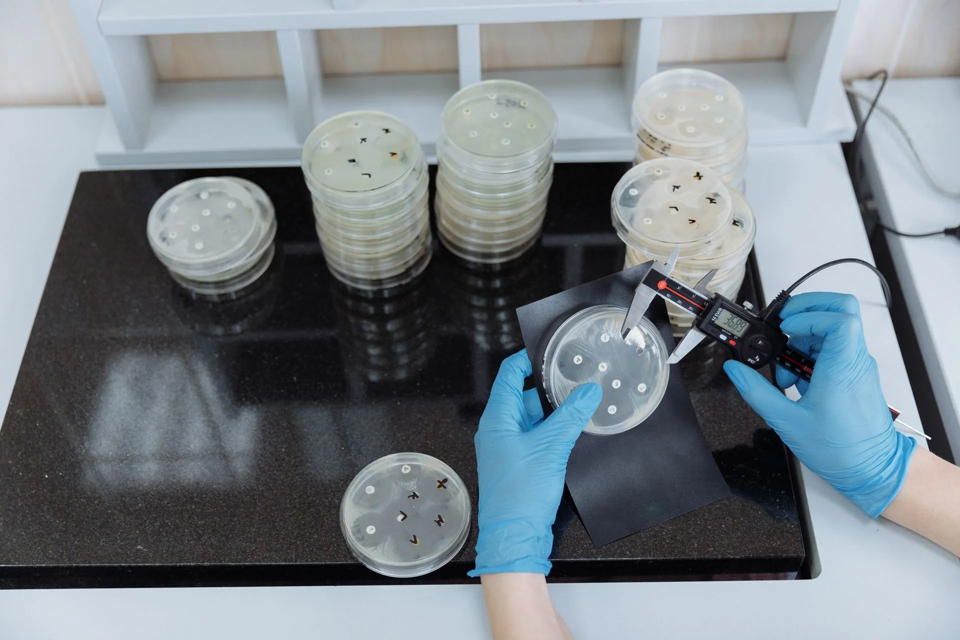 Scientist measuring bacteria growth in petri dishes under sterile lab conditions, illustrating Tiny Health raises $33 million for microbiome testing that insurance doesn't cover
